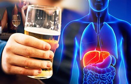 Tìm ra cách  đảo ngược bệnh viêm gan do rượu bia