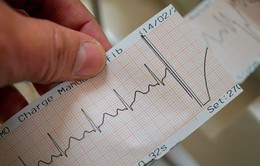 Nhịp tim như thế nào thì nguy hiểm?