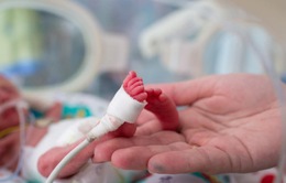 Tiến bộ y học giảm đáng kể tỷ lệ trẻ sinh non tử vong