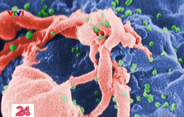 Thêm một bệnh nhân loại bỏ được virus HIV/AIDS khỏi cơ thể