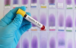 Mỹ: Bang Pennsylvania công bố bùng phát dịch viêm gan A