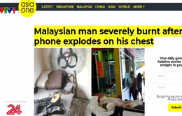 Điện thoại phát nổ khi sạc, nam thanh niên Malaysia bỏng nặng