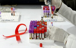 Tỷ lệ tử vong do HIV/AIDS trên thế giới có xu hướng giảm