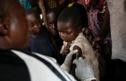 Dịch sởi khiến hơn 2.700 người thiệt mạng trong vòng 7 tháng tại CHDC Congo