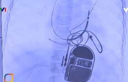 Lần đầu tiên đặt máy chống rung để ổn định nhịp tim cho trẻ