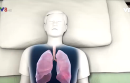 Liên tiếp ghi nhận các trường hợp viêm phổi cấp