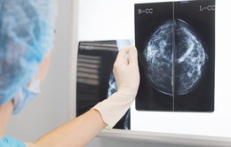 Trí tuệ nhân tạo có khả năng phát hiện ung thư vú
