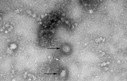Trung Quốc xác nhận trường hợp thứ 3 tử vong do virus Corona