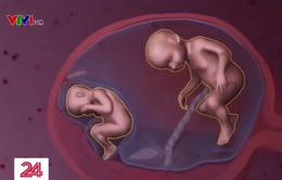 Y học bào thai - Kỳ tích được tạo nên từ những nỗ lực