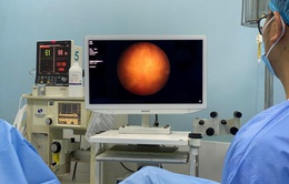 Ứng dụng laser trong điều trị ung thư bàng quang không xâm lấn cơ