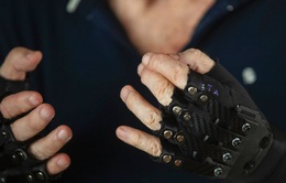 Găng tay sinh học - Hy vọng mới cho những người mất kiểm soát bàn tay