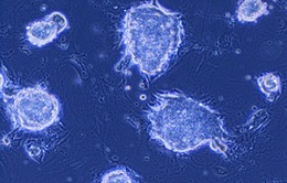 Thử nghiệm tế bào gốc iPS để chữa bệnh Parkinson