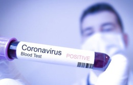 Đã có kết quả xét nghiệm bố bệnh nhân thứ 17 nhiễm COVID-19