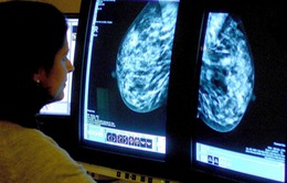 Phương pháp điều trị ung thư vú chỉ tốn 5 phút mỗi lần