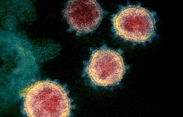 Phát hiện biến thể của virus SARS-CoV-2 gây triệu chứng nhẹ hơn tại Singapore