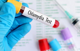 Phòng bệnh lây truyền qua đường tình dục Chlamydia