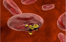 Phát hiện biến thể máu hiếm giúp ngăn bệnh sốt rét