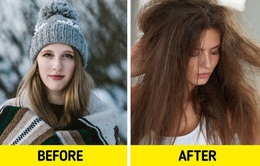 Mẹo hiệu quả khắc phục tóc khô, chẻ ngọn, gãy rụng vào mùa đông