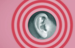 25% dân số thế giới có nguy cơ mắc các bệnh về thính giác vào năm 2050