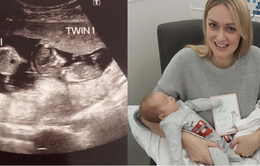 Hiếm gặp: Có bầu khi đang mang thai 3 tháng