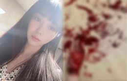 Kwon Mina (AOA) đăng hình tự tử gây choáng