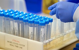 Biến thể SARS-CoV-2 ở Pháp có thể "né" được xét nghiệm PCR