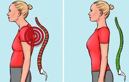7 bài tập cải thiện tư thế và giảm đau lưng