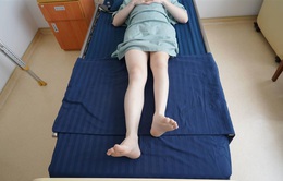 Kỳ tích kéo dài chân 13cm cho bệnh nhân ung thư xương
