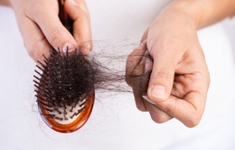 Rụng tóc - dấu hiệu cảnh báo sức khỏe đang gặp vấn đề