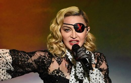 Cuộc tuyên chiến đối đầu mang lại vai biểu diễn Madonna thời trẻ con đặc biệt khốc liệt