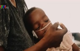 Châu Phi đối mặt với nguy cơ bùng phát các dịch bệnh