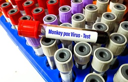CDC Mỹ xác nhận bằng chứng về sự lây truyền bệnh đậu mùa khỉ tại địa phương