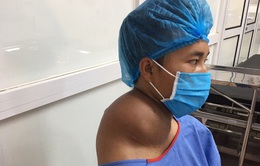 Phẫu thuật khối u khổng lồ vùng cổ cho nam bệnh nhân trẻ tuổi