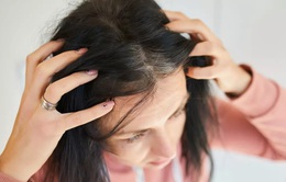 Căng thẳng có khiến tóc bạc không?