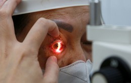 Lai Châu: Phối hợp giám sát chặt chẽ, hạn chế bệnh đau mắt đỏ lây lan
