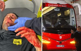 HLV Fabio Grosso của Lyon chấn thương vì bị CĐV ném đá
