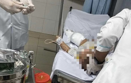 Bình Thuận: Ném bom xăng vào nhà người thiếu nợ làm 3 người bị thương