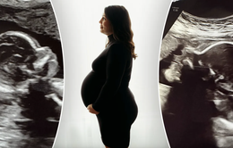 Kỳ lạ người phụ nữ có hai tử cung mang thai đôi, mỗi tử cung một thai nhi