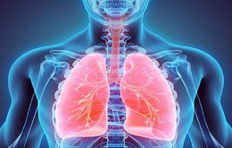 Viêm phổi ở bệnh nhân đái tháo đường