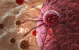 Phát hiện mới về cách hệ miễn dịch nhận biết và tiêu diệt tế bào ung thư