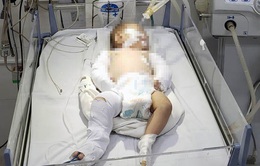 Cấp cứu bé gái 3 tháng tuổi bị đa chấn thương, nghi bị bạo hành