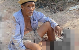 Bình Định: Truy tìm lái xe cán nát chân cụ ông 85 tuổi rồi bỏ trốn