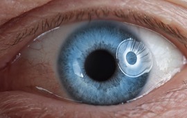 Phẫu thuật võng mạc dịch kính - giải pháp giảm nguy cơ mù loà