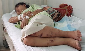 Vụ cô gái bị đánh đến sảy thai: Bắt nghi phạm cuối cùng