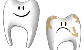 Những thói quen không tốt làm tổn thương răng