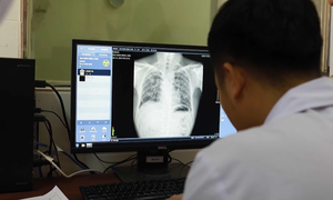 Nghệ An: Phát hiện thêm nhiều công nhân mắc bệnh bụi phổi