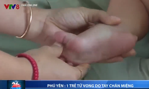 Phú Yên: 1 trẻ bị tử vong do bệnh tay chân miệng