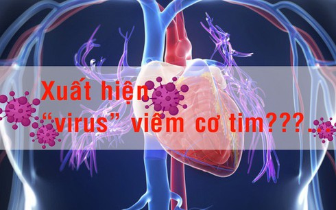 [Infographic] - Thực hư "virus" viêm cơ tim?
