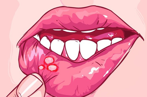 6 mẹo đơn giản giúp bạn chăm sóc răng miệng sạch sẽ