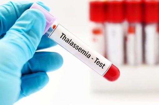 Tăng cường phổ cập thông tin về bệnh Thalassemia để nâng cao chất lượng giống nòi Việt